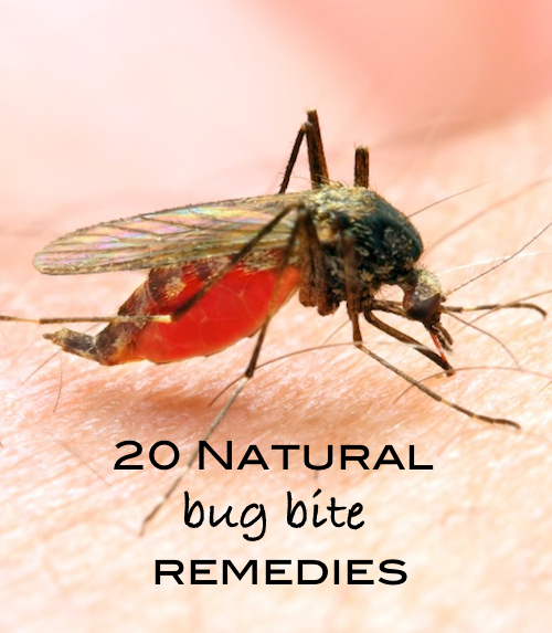 Summer Care Tip- 20 Natural Bug Bite Remedies | OnePartSunshine.com